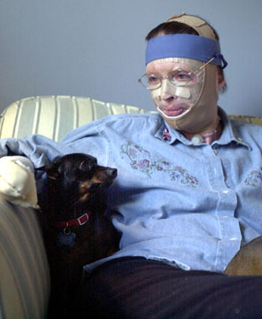 The most injured survivor of the Pentagon attack comes home
